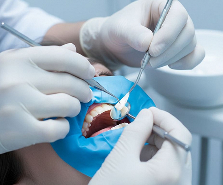 Kad jāmaina vecā plomba? 5 pazīmes, ka laiks apmeklēt zobārstu