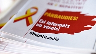 Atceļ pacientu ar HIV ārstēšanas līdzšinējos ierobežojumus