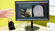Bērnu slimnīca saņem 89 000 eiro vērtu ierīci, kas ļaus bērniem pilnībā atbrīvoties no epilepsijas lēkmēm