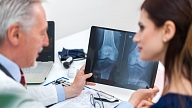 Osteoporoze - slimība, kas nešķiro ne vecumu, ne dzimumu
