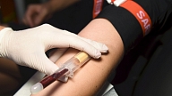 Prezentēs pētījumu par HIV izplatību Latvijā un jaunākajām ārstēšanas iespējām