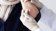 Psoriāze – ādas slimība mūža garumā

