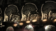 Trīs ārstniecības iestādēs sāk veikt valsts apmaksātu PET izmeklējumu pacientiem ar onkoloģiskām diagnozēm