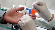 Tuvākajā laikā varētu tapt jauns HIV pacientu reģistrs