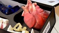 VM plāno veidot "zaļo koridoru" sirds un asinsvadu slimību diagnostikai