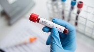 Eksperte: HIV/AIDS inficēto pacientu skaits Latvijā turpina pieaugt

