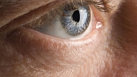Kā pasargāt sevi no glaukomas un tās izraisītās redzes invaliditātes?
