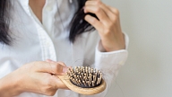Kādi ir biežākie matu izkrišanas jeb alopēcijas cēloņi? Skaidro dermatoveneroloģe