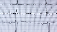 Kardiologs: Sirds un asinsvadu slimības rada īpaši augstu risku saslimt ar Covid-19