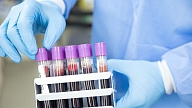 Latvijā laboratorijas varēs izmantot ātros molekulāri bioloģiskos COVID-19 testus