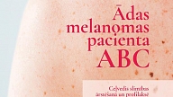 Melanomas pacientiem jauns izglītojošs ceļvedis par slimības ārstēšanu un profilaksi