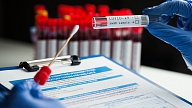 Pieaug Covid-19 infekcijas reproduktivitātes koeficients un no ārzemēm ievesto inficēšanās gadījumu īpatsvars
