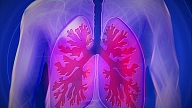 Vai tuberkulozes slimniekiem ir lielāks risks saslimt ar Covid-19?

