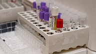 Testēšanas nedēļas laikā trīs cilvēkiem Austrumu slimnīcā atklāj C-hepatīta antivielas, informē par HIV un C-hepatīta ārstēšanas iespējām
