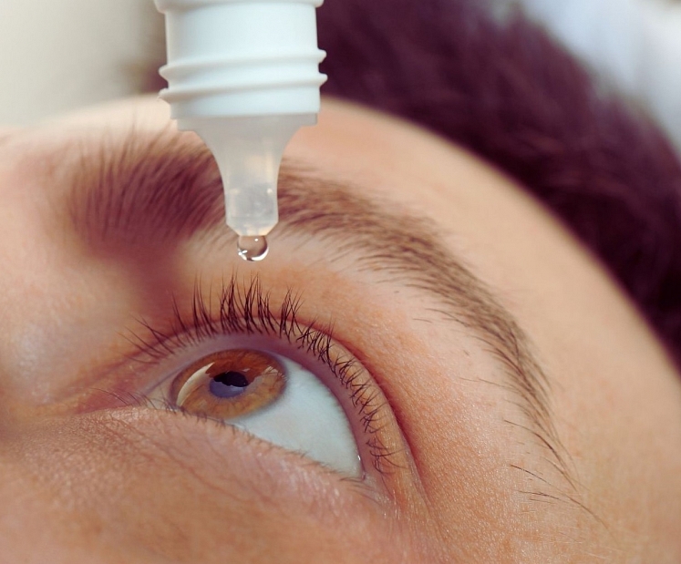 Sausās acs sindroms: simptomi, cēloņi, profilakse un ārstēšana