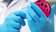 SPKC: Pabeigta epidemioloģiskā izmeklēšana par pavasarī notikušo Escherichia coli izraisīto uzliesmojumu