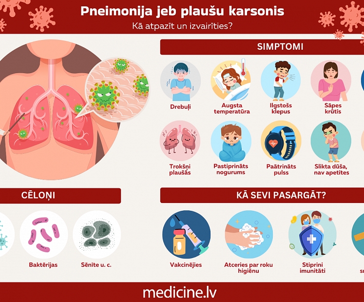 Kā atpazīt pneimoniju jeb plaušu karsoni? (INFOGRAFIKA)