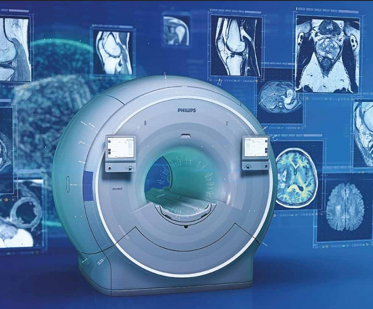 Kā sagatavoties magnētiskās rezonanses izmeklējumam (MRI) – viss, kas jāzina pacientam