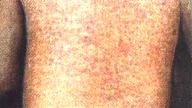 MASALAS