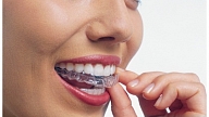 Smaidi pārliecinoši ar "Invisalign"