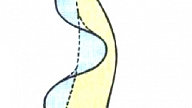 TRIPANOSOMOZES