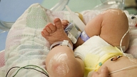 VM plāno samazināt zīdaiņu mirstību un uzlabot mātes veselību