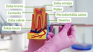Zobu kopšanas paradumi, kas var pasargāt no periodontīta: Iesaka speciālisti