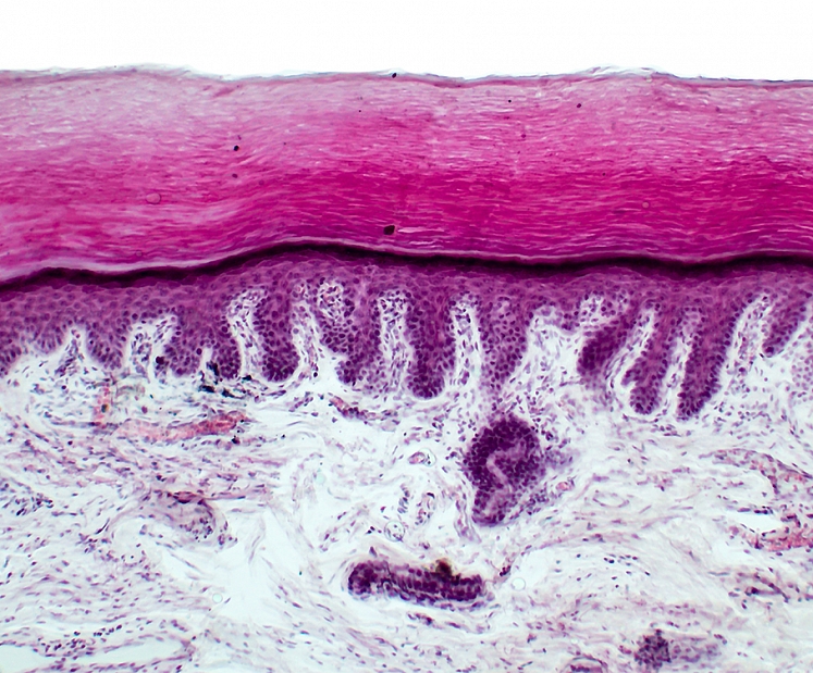 Histoloģisko izmeklējumu nozīme un pielietojums ādas saslimšanu diagnostikā