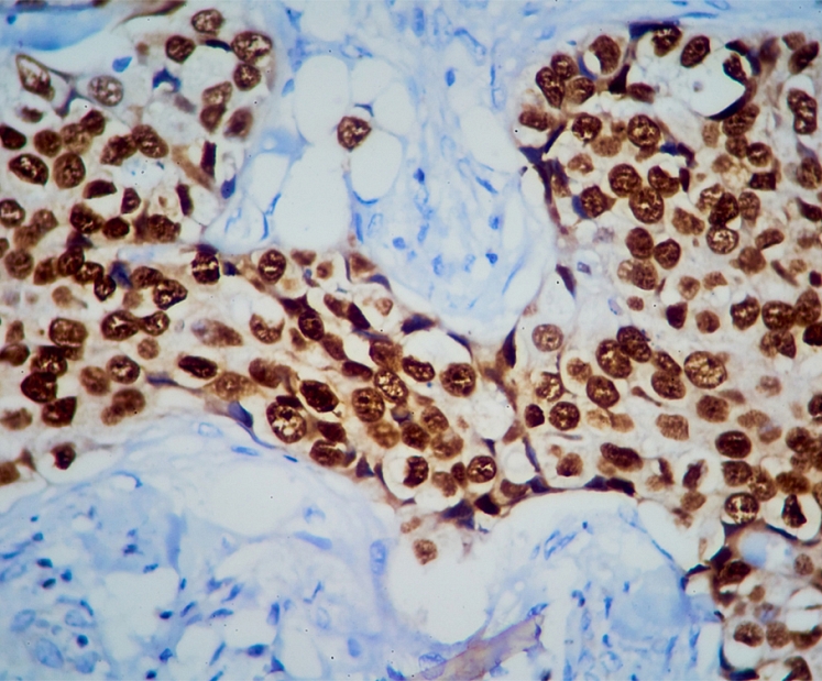 Imūnhistoķīmija un tās nozīme diagnostikā