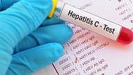 Austrumu slimnīcas infektologi un hepatologi aicina pieteikties C hepatīta un/vai HIV bezmaksas testiem – agrīna diagnostika ir izšķiroša