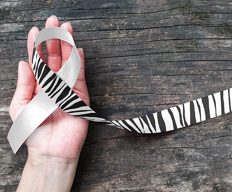 Retā slimība, no kuras mira Stīvs Džobs. Ko par to zinām šodien?