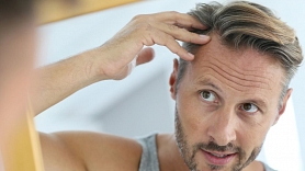 Plikpaurība vīriešiem: Kā samazināt matu izkrišanu?

