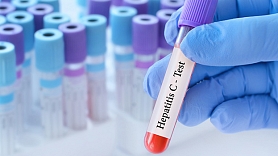 Sociālajā kampaņā “Atklāj. Rīkojies!” piedalījās vairāk nekā 5100 cilvēku; 4% bijis pozitīvs C hepatīta tests