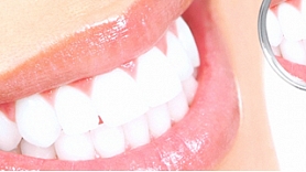 Liec savam smaidam mirdzēt – zobārstniecības klīnikas "Adenta" estētiskā zobārstniecība