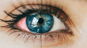 Par ko var liecināt sarkanas acis un ko iesākt? Stāsta farmaceite