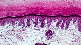 Histoloģisko izmeklējumu nozīme un pielietojums ādas saslimšanu diagnostikā