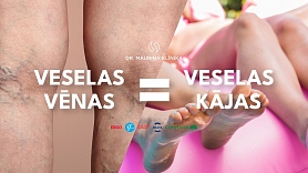 Ak, šis neglītais vēnu zīmējums...