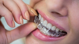 Zobu kapes – kas jāievēro, tās lietojot? Stāsta speciālisti