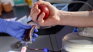 Austrumu slimnīcā krasi sarucis asins krājums, tāpēc lūdz atsaukties donorus