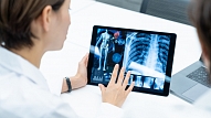 Eksperti: Datu digitalizācija ir veselības aprūpes nākotne