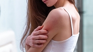 Ekzēma – ādas slimība, kas liek mainīt ikdienas paradumus

