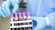 Latvijā laboratorijas varēs izmantot ātros molekulāri bioloģiskos COVID-19 testus

