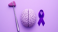 28. oktobrī Stradiņa slimnīcā notiks informatīvs pasākums epilepsijas pacientiem un sabiedrībai