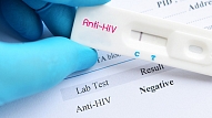 Noslēgusies HIV un C hepatīta testēšanas nedēļa Austrumu slimnīcā: HIV gadījumi nav atklāti, 15 cilvēkiem konstatētas C hepatīta antivielas