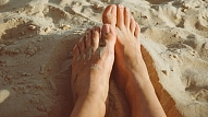 Sēnīšu infekcijas, varžacis, tulznas un sausa āda: Kā izvairīties no vasarā izplatītām pēdu problēmām?