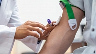 Baltijas HIV asociācija: Aicinām testēties uz C hepatītu visus vēl nepārbaudītos!
