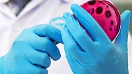 SPKC: Pabeigta epidemioloģiskā izmeklēšana par pavasarī notikušo Escherichia coli izraisīto uzliesmojumu