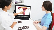 Endometrija polipi: Simptomi, cēloņi, ārstēšana