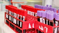 ASV izstrādāts asins analīžu tests augļa Dauna sindroma atklāšanai