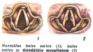 DZIEDĀTĀJU MEZGLIŅI